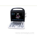 Color Doppler Ultrasound System For Hostipal